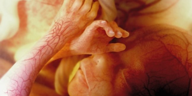 Une nouvelle étude met en lumière la douleur horrible ressentie par les bébés lors d'un avortement Fetalpainpic-648x324
