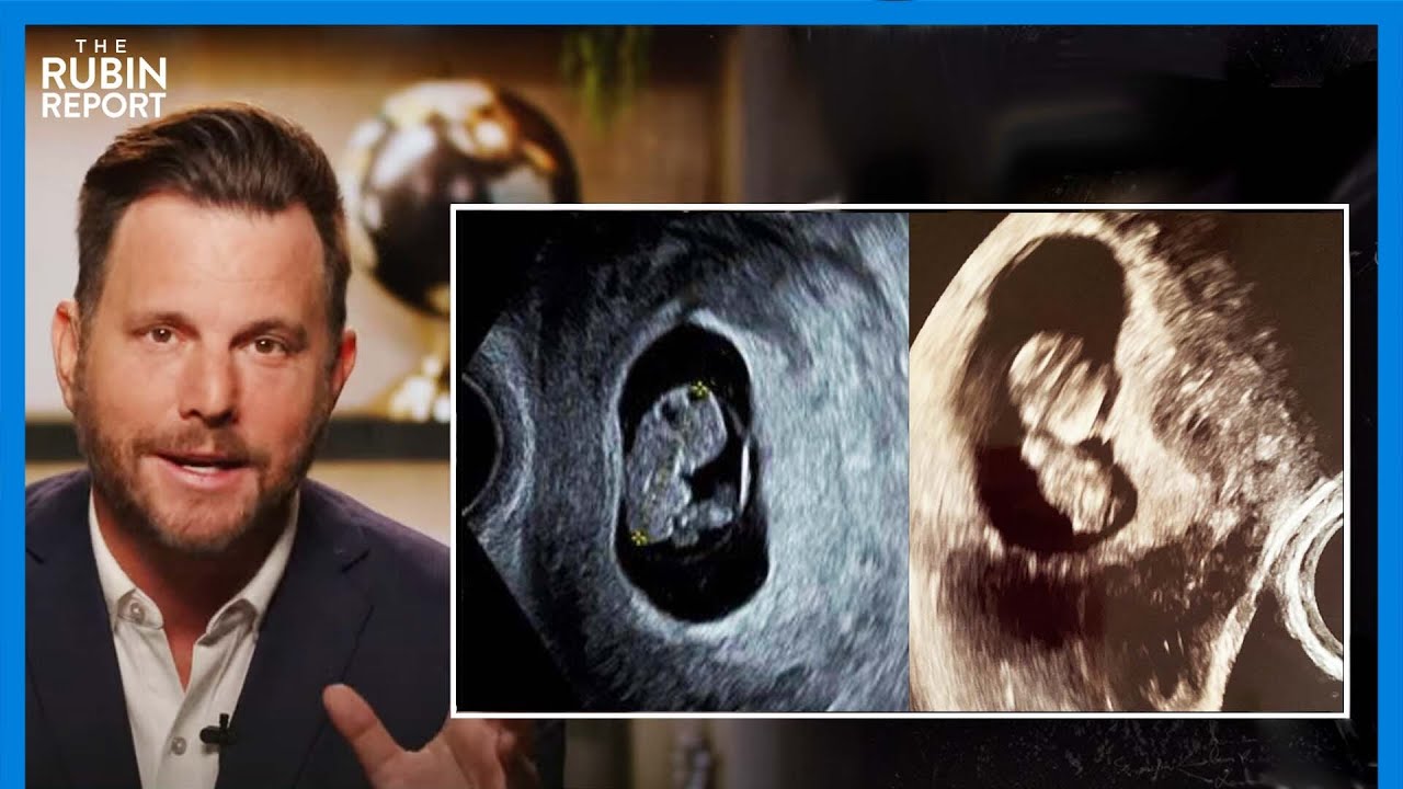 Dave Rubin says he'd ask his surrogate to abort any disabled baby