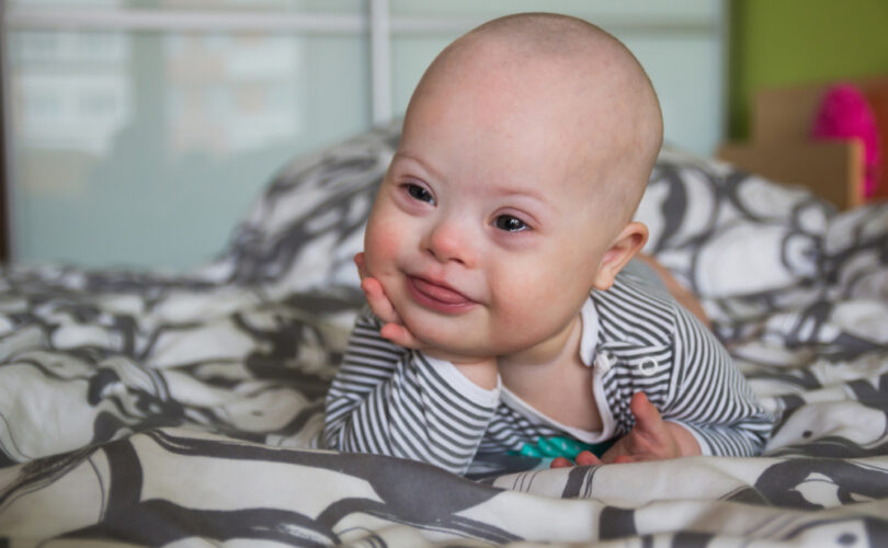 Portrait of cute baby boy with Down syndrome