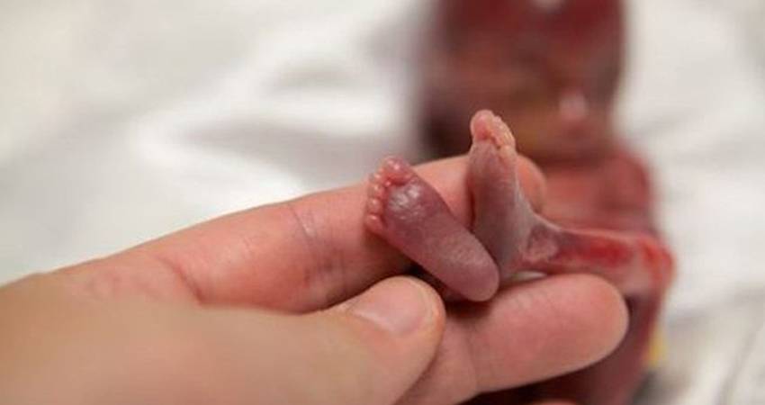 Live birth abortions on the rise in Canada and Ireland
