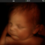 Image,Of,Newborn,Baby,Like,3d,Ultrasound,Of,Baby,In