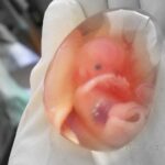 Human_fetus_10_weeks_-_therapeutic_abortion