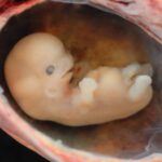 Human_Embryo_-_Approximately_8_weeks_estimated_gestational_age