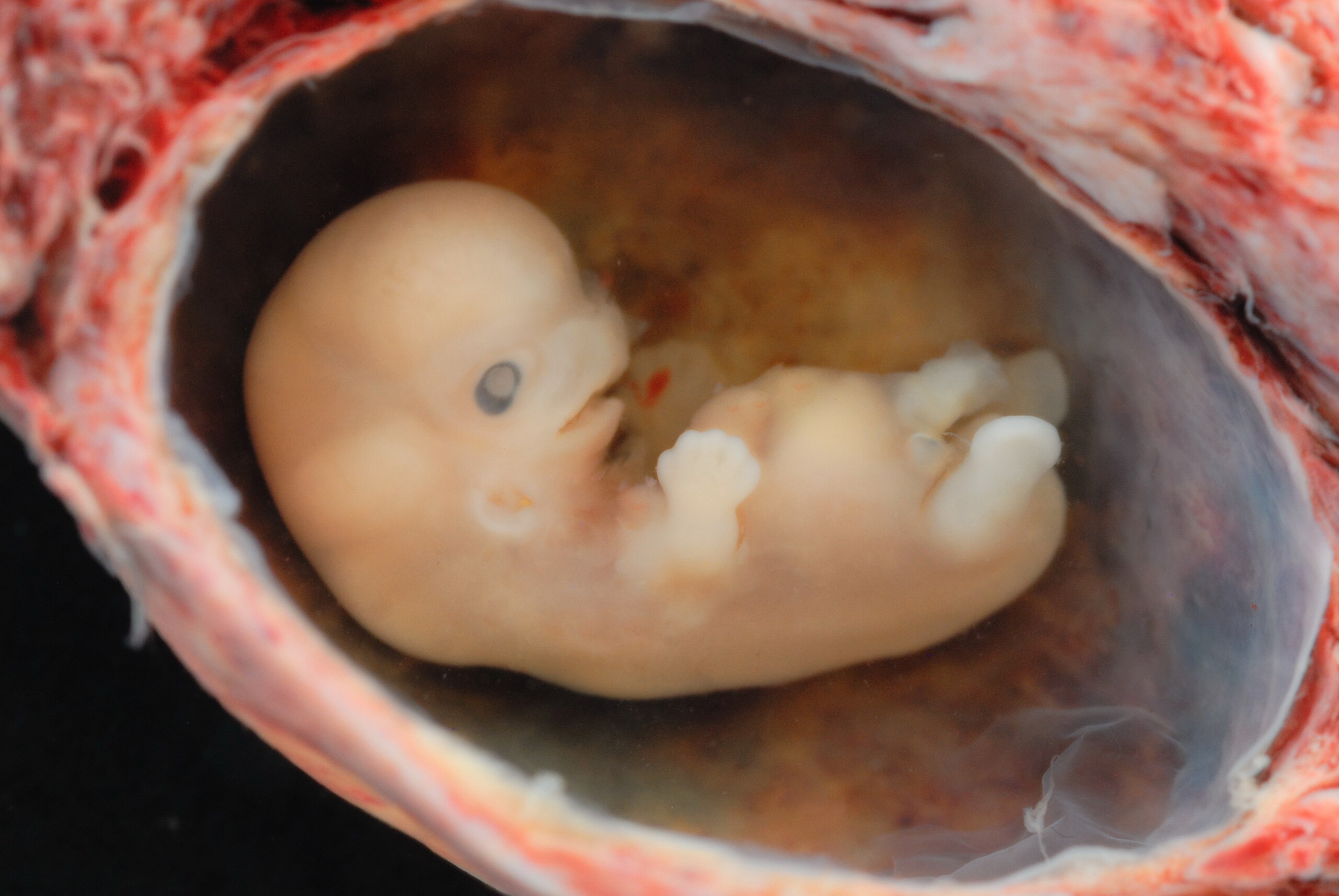 Human_Embryo_-_Approximately_8_weeks_estimated_gestational_age