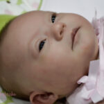 When Eugenics Goes Viral Trisomy_21_-_Down_Syndrome_-_Kennedi_Beahn_-_presented_by_Kraig_Beahn